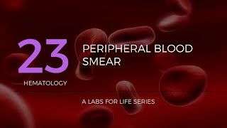 Making and staining blood smears [upl. by Anirehc208]