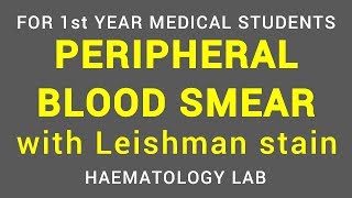 PERIPHERAL BLOOD SMEAR  LEISHMAN STAIN  HAEMATOLOGY LAB  PHYSIOLOGY [upl. by Collen257]