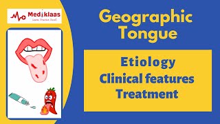 Geographic tongue Benign Migratory Glossitis [upl. by Nnylakcaj]