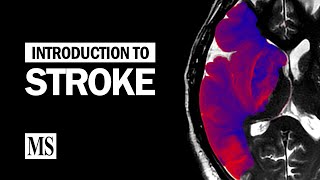 Brainstem Stroke Syndromes [upl. by Earased677]