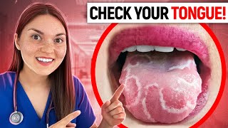 What your TONGUE says about your HEALTH Doctor Explains [upl. by Nnyltiak]