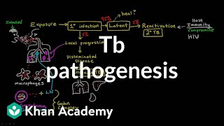 Rheumatoid Arthritis RA  Autoimmune Joint Disease  Pathophysiology  Rheumatology Playlist [upl. by Lahcar]