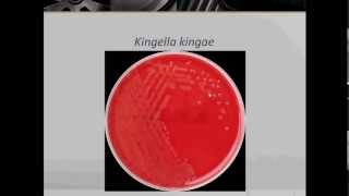 Bacteriology Gram Negative Coccobacilli Part 1 [upl. by Neelhtakyram]