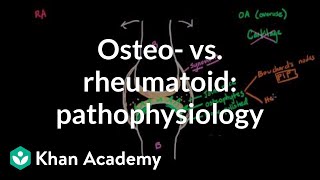 Rheumatoid Arthritis Pathophysiology and Drug Classification [upl. by Mirelle]