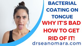 Bacterial Coating on Tongue Why it’s Bad How to Get Rid of It [upl. by Neda]