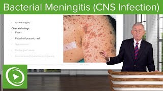 Bacterial Meningitis CNS Infection – Infectious Diseases  Lecturio [upl. by Mckeon]