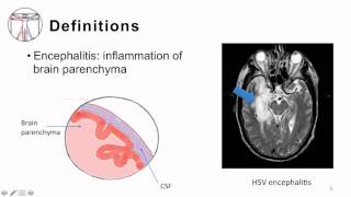 2 Bacterial Meningitis Pathogenesis and Clinical Manifestion [upl. by Zeta496]