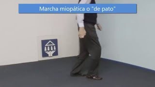 Marcha miopática o quoten patoquot [upl. by Adnirak]