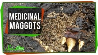 Marvelous Medicinal Maggots [upl. by Venola]