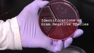 10 How to Identify Gram Negative Species [upl. by Conley]