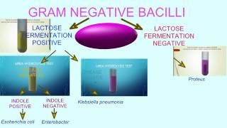 FLOWCHART OF BACTERIAL TESTS GRAM NEGATIVE BACILLI [upl. by Mitchael597]