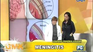 What is Meningitis [upl. by Kienan]