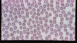 Blood Smear Evaluation [upl. by Nathan]